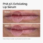 PHA 5% Exfoliating Lip Serum - Image 4